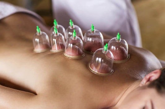 Cuppingmassage, wat is het? - Intertaping.nl